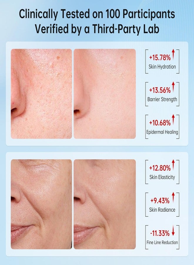 VGO 2 Pack 92% Snail Mucin Moisturizer, Anti Aging, Skin Repair & Hydrating Face Cream with Ceramide & Vitamin E - Image 5